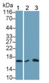 Western Blot; Sample: Lane1: Jurkat cell lysate; Lane2: Mouse Cerebrum lysate; Lane3: Rat Cerebrum lysate Primary Ab: 0.5ug/ml Mouse Anti-Human IL5 Antibody Second Ab: 0.2ug/mL HRP-Linked Caprine Anti-Mouse IgG Polyclonal Antibody