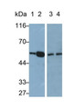 Western Blot; Sample: Lane1: Mouse Heart lysate; Lane2: Mouse Liver lysate; Lane3: K562 cell lysate; Lane4: MCF7 cell lysate Primary Ab: 0.1ug/ml Rabbit Anti-Mouse PPARg Antibody Second Ab: 0.2ug/mL HRP-Linked Caprine Anti-Rabbit IgG Polyclonal Antibody