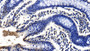 DAB staining on IHC-P; Sample: Human Colon Tissue; Primary Ab: 10ug/ml Rabbit Anti-Human NOLC1 Antibody Second Ab: 2ug/mL HRP-Linked Caprine Anti-Rabbit IgG Polyclonal Antibody