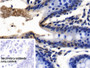 DAB staining on IHC-P; Sample: Human Colon Tissue; Primary Ab: 10ug/ml Rabbit Anti-Human NOLC1 Antibody; Control: Used PBS instead of primary antibody; Second Ab: 2ug/ml HRP-Linked Caprine Anti-Rabbit IgG Polyclonal Antibody