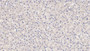 DAB staining on IHC-P; Sample: Human Liver Tissue; Primary Ab: 30ug/ml Mouse Anti-Human Visfatin Antibody Second Ab: 2ug/mL HRP-Linked Caprine Anti-Mouse IgG Polyclonal Antibody