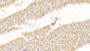 DAB staining on IHC-P; Sample: Human Cardiac Muscle Tissue; Primary Ab: 20ug/ml Mouse Anti-Human IL18 Antibody; Second Ab: 2ug/mL HRP-Linked Caprine Anti-Mouse IgG Polyclonal Antibody