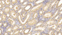 DAB staining on IHC-P; Sample: Human Kidney Tissue; Primary Ab: 20ug/ml Mouse Anti-Human IL18 Antibody; Second Ab: 2ug/mL HRP-Linked Caprine Anti-Mouse IgG Polyclonal Antibody