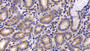DAB staining on IHC-P; Sample: Human Stomach Tissue; Primary Ab: 30ug/ml Mouse Anti-Human CXCL16 Antibody Second Ab: 2ug/mL HRP-Linked Caprine Anti-Mouse IgG Polyclonal Antibody