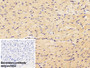 DAB staining on IHC-P; Sample: Mouse Cardiac Muscle Tissue; Primary Ab: 10ug/ml Rabbit Anti-Human VEGFA Antibody; Control: Used PBS instead of primary antibody; Second Ab: 2ug/ml HRP-Linked Caprine Anti-Rabbit IgG Polyclonal Antibody
