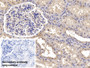 DAB staining on IHC-P; Sample: Human Kidney Tissue; Primary Ab: 10ug/ml Mouse Anti-Human CNX Antibody; Control: Used PBS instead of primary antibody; Second Ab: 2ug/ml HRP-Linked Caprine Anti-Mouse IgG Polyclonal Antibody