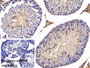 DAB staining on IHC-P; Sample: Mouse Testis Tissue Primary Ab: 30ug/ml Mouse Anti-Mouse CLEC7A Antibody Control: Used PBS instead of primary antibody Second Ab: 2ug/ml HRP-Linked Caprine Anti-Mouse IgG Polyclonal Antibody