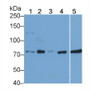 Western Blot; Sample: Lane1: K562 cell lysate; Lane2: A549 cell lysate; Lane3: HepG2 cell lysate; Lane4: Raji cell lysate; Lane5: Human Serum; Primary Ab: 1.5ug/ml Mouse Anti-Human RIPK1 Antibody; Second Ab: 0.2ug/mL HRP-Linked Caprine Anti-Mouse IgG Polyclonal Antibody