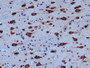 DAB staining on IHC-P; Sample: Human Cerebrum Tissue; Primary Ab: 10ug/ml Mouse Anti-Human ENG Antibody; Second Ab: 2ug/mL HRP-Linked Caprine Anti-Mouse IgG Polyclonal Antibody