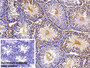 DAB staining on IHC-P; Sample: Rat Testis Tissue; Primary Ab: 10ug/ml Rabbit Anti-Rat IgG Antibody; Control: Used PBS instead of primary antibody; Second Ab: 2ug/ml HRP-Linked Caprine Anti-Rabbit IgG Polyclonal Antibody