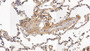 DAB staining on IHC-P; Sample: Human Lung Tissue; Primary Ab: 10ug/ml Rabbit Anti-Simian b2M Antibody; Second Ab: 2ug/mL HRP-Linked Caprine Anti-Rabbit IgG Polyclonal Antibody