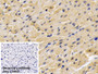 DAB staining on IHC-P; Sample: Human Cardiac Muscle Tissue; Primary Ab: 20ug/ml Mouse Anti-Human ADPN Antibody; Control: Used PBS instead of primary antibody; Second Ab: 2ug/ml HRP-Linked Caprine Anti-Mouse IgG Polyclonal Antibody