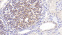 DAB staining on IHC-P; Sample: Porcine Kidney Tissue; Primary Ab: 20ug/ml Mouse Anti-Porcine IL2 Antibody Second Ab: 2ug/mL HRP-Linked Caprine Anti-Mouse IgG Polyclonal Antibody