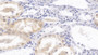 DAB staining on IHC-P; Samples: Human Kidney Tissue; Primary Ab: 30ug/ml Mouse Anti-Human HPD Antibody Second Ab: 2ug/mL HRP-Linked Caprine Anti-Mouse IgG Polyclonal Antibody