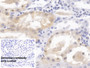 DAB staining on IHC-P; Sample: Human Kidney Tissue; Primary Ab: 30ug/ml Mouse Anti-Human HPD Antibody; Control: Used PBS instead of primary antibody; Second Ab: 2ug/ml HRP-Linked Caprine Anti-Mouse IgG Polyclonal Antibody
