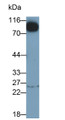 Western Blot; Sample: Rat Cerebrum lysate Primary Ab: 0.1ug/ml Mouse Anti-Human WFS1 Antibody Second Ab: 0.2ug/ml HRP-Linked Caprine Anti-Mouse IgG Polyclonal Antibody