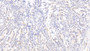 DAB staining on IHC-P; Samples: Human Small intestine Tissue; Primary Ab: 30ug/ml Mouse Anti-Human Rac1 Antibody Second Ab: 2ug/mL HRP-Linked Caprine Anti-Mouse IgG Polyclonal Antibody