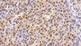 DAB staining on IHC-P; Samples: Rat Ovary Tissue; Primary Ab: 20ug/ml Mouse Anti-Rat Trx Antibody; Second Ab: 2ug/mL HRP-Linked Caprine Anti-Mouse IgG Polyclonal Antibody