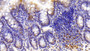 DAB staining on IHC-P; Samples: Rat Colon Tissue; Primary Ab: 20ug/ml Mouse Anti-Rat Trx Antibody; Second Ab: 2ug/mL HRP-Linked Caprine Anti-Mouse IgG Polyclonal Antibody