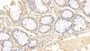 DAB staining on IHC-P; Sample: Porcine Colon Tissue; Primary Ab: 20ug/ml Mouse Anti-Porcine OPN Antibody; Second Ab: 2ug/mL HRP-Linked Caprine Anti-Mouse IgG Polyclonal Antibody