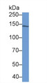 Western Blot; Sample: A549 cell lysate Primary Ab: 2ug/ml Mouse Anti-Human IARS Antibody Second Ab: 0.2ug/mL HRP-Linked Caprine Anti-Mouse IgG Polyclonal Antibody