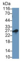 Western Blot; Sample: Human Lung lysate Primary Ab: 0.5ug/ml Mouse Anti-Human CD8b Antibody Second Ab: 0.2ug/mL HRP-Linked Caprine Anti-Mouse IgG Polyclonal Antibody