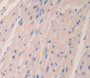 Used in DAB staining on fromalin fixed paraffin- embedded Kidney tissue