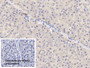 DAB staining on IHC-P; Sample: Porcine Liver Tissue; Primary Ab: 20ug/ml Rabbit Anti-Porcine Plg Antibody; Control: Used PBS instead of primary antibody; Second Ab: 2ug/ml HRP-Linked Caprine Anti-Rabbit IgG Polyclonal Antibody