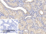 DAB staining on IHC-P; Sample: Porcine Kidney Tissue; Primary Ab: 20ug/ml Rabbit Anti-Porcine Plg Antibody; Control: Used PBS instead of primary antibody; Second Ab: 2ug/ml HRP-Linked Caprine Anti-Rabbit IgG Polyclonal Antibody