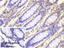 DAB staining on IHC-P; Samples: Porcine Small intestine Tissue; Primary Ab: 20ug/ml Rabbit Anti-Porcine CSTA Antibody Second Ab: 2ug/mL HRP-Linked Caprine Anti-Rabbit IgG Polyclonal Antibody