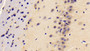 DAB staining on IHC-P; Samples: Rat Cerebrum Tissue; Primary Ab: 10ug/ml Rabbit Anti-Rat RETN Antibody Second Ab: 2ug/mL HRP-Linked Caprine Anti-Rabbit IgG Polyclonal Antibody