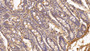 DAB staining on IHC-P; Sample: Human Small intestine Tissue; Primary Ab: 20ug/ml Mouse Anti-Human PIIINP Antibody; Second Ab: 2ug/mL HRP-Linked Caprine Anti-Mouse IgG Polyclonal Antibody
