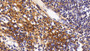 DAB staining on IHC-P; Sample: Human Lymph node Tissue; Primary Ab: 20ug/ml Mouse Anti-Human PIIINP Antibody; Second Ab: 2ug/mL HRP-Linked Caprine Anti-Mouse IgG Polyclonal Antibody