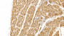 DAB staining on IHC-P; Sample: Human Cardiac Muscle Tissue; Primary Ab: 10ug/ml Mouse Anti-Human MYO Antibody Second Ab: 2ug/mL HRP-Linked Caprine Anti-Mouse IgG Polyclonal Antibody