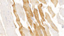 DAB staining on IHC-P; Sample: Human Skeletal muscle Tissue; Primary Ab: 30ug/ml Mouse Anti-Human MYO Antibody; Second Ab: 2ug/mL HRP-Linked Caprine Anti-Mouse IgG Polyclonal Antibody