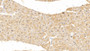 DAB staining on IHC-P; Sample: Human Cardiac Muscle Tissue; Primary Ab: 10ug/ml Mouse Anti-Human MYO Antibody; Second Ab: 2ug/mL HRP-Linked Caprine Anti-Mouse IgG Polyclonal Antibody