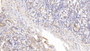 DAB staining on IHC-P; Sample: Porcine Small Intestine Tissue; Primary Ab: 10ug/ml Mouse Anti-Human FABP4 Antibody; Second Ab: 2ug/mL HRP-Linked Caprine Anti-Mouse IgG Polyclonal Antibody