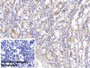 DAB staining on IHC-P; Sample: Human Small intestine Tissue; Primary Ab: 10ug/ml Mouse Anti-Human FABP4 Antibody; Control: Used PBS instead of primary antibody; Second Ab: 2ug/ml HRP-Linked Caprine Anti-Mouse IgG Polyclonal Antibody