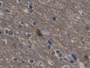 DAB staining on IHC-P; Sample: Human Cerebrum Tissue; Primary Ab: 30ug/ml Mouse Anti-Human NSE Antibody Second Ab: 2ug/mL HRP-Linked Caprine Anti-Mouse IgG Polyclonal Antibody