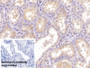 DAB staining on IHC-P; Sample: Porcine Kidney Tissue; Primary Ab: 40ug/ml Mouse Anti-Porcine APOA1 Antibody; Control: Used PBS instead of primary antibody; Second Ab: 2ug/ml HRP-Linked Caprine Anti-Mouse IgG Polyclonal Antibody