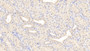 DAB staining on IHC-P; Sample: Human Kidney Tissue; Primary Ab: 20ug/ml Rabbit Anti-Human F2 Antibody Second Ab: 2ug/mL HRP-Linked Caprine Anti-Rabbit IgG Polyclonal Antibody
