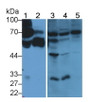 Western Blot; Sample: Lane1: Human Serum; Lane2: Human Urine; Lane3: Porcine Liver lysate; Lane4: Porcine Kidney lysate; Lane5: HepG2 cell lysate; Primary Ab: 2ug/ml Rabbit Anti-Human a2PI Antibody; Second Ab: 0.2ug/mL HRP-Linked Caprine Anti-Rabbit IgG Polyclonal Antibody