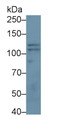 Western Blot; Sample: Jurkat cell lysate Primary Ab: 3ug/ml Mouse Anti-Rat NRP2 Antibody Second Ab: 0.2ug/mL HRP-Linked Caprine Anti-Mouse IgG Polyclonal Antibody