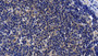DAB staining on IHC-P; Sample: Human Lymph node Tissue; Primary Ab: 10ug/ml Rabbit Anti-Human PARG Antibody; Second Ab: 2ug/mL HRP-Linked Caprine Anti-Rabbit IgG Polyclonal Antibody