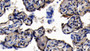 DAB staining on IHC-P; Sample: Human Placenta Tissue; Primary Ab: 10ug/ml Rabbit Anti-Human STAG2 Antibody Second Ab: 2ug/mL HRP-Linked Caprine Anti-Rabbit IgG Polyclonal Antibody