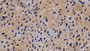 DAB staining on IHC-P; Sample: Human Cardiac Muscle Tissue; Primary Ab: 10ug/ml Rabbit Anti-Human STAG2 Antibody; Second Ab: 2ug/mL HRP-Linked Caprine Anti-Rabbit IgG Polyclonal Antibody