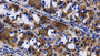 DAB staining on IHC-P; Sample: Human Stomach Tissue; Primary Ab: 10ug/ml Rabbit Anti-Human STAG2 Antibody; Second Ab: 2ug/mL HRP-Linked Caprine Anti-Rabbit IgG Polyclonal Antibody