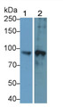 Western Blot; Sample: Lane1: THP1 cell lysate; Lane2: 293T cell lysate Primary Ab: 0.6ug/ml Rabbit Anti-Human FOXP2 Antibody Second Ab: 0.2ug/mL HRP-Linked Caprine Anti-Rabbit IgG Polyclonal Antibody