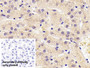 DAB staining on IHC-P; Sample: Human Liver Tissue; Primary Ab: 20ug/ml Mouse Anti-Human AT Antibody; Control: Used PBS instead of primary antibody; Second Ab: 2ug/ml HRP-Linked Caprine Anti-Mouse IgG Polyclonal Antibody