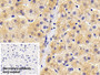 DAB staining on IHC-P; Sample: Human Liver Tissue; Primary Ab: 20ug/ml Mouse Anti-Human AT Antibody; Control: Used PBS instead of primary antibody; Second Ab: 2ug/ml HRP-Linked Caprine Anti-Mouse IgG Polyclonal Antibody